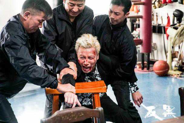 手上脱皮就是真菌感染吗? 手上脱皮就是真菌感染吗?